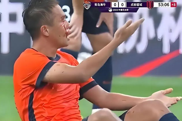 "역시 최강희가 옳았다! 명장은 다르다!"…中 감탄했다, 현지 언론 뒤늦게 인정→중국 귀화 선수 경기 중 팔꿈치 가격→상대 선수 얼굴 '피 철철'